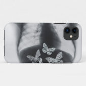 胃の蝶のX線 Case-Mate iPhoneケース (裏面(横))