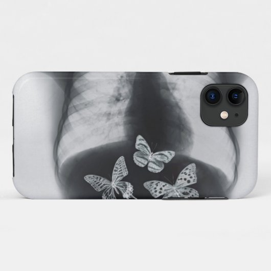 胃の蝶のX線 Case-Mate iPhoneケース (裏面(横))