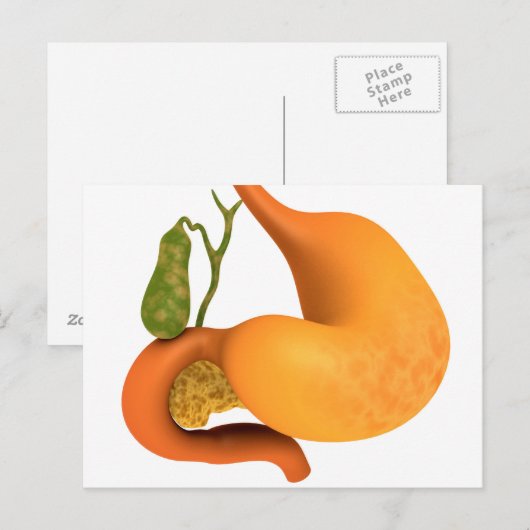 胃胆嚢 ポストカード (正面/裏面)