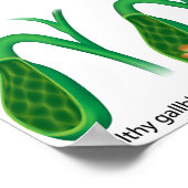 胆石と肝臓ポスター ポスター (角)