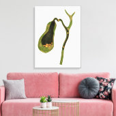 胆石内部の概念図 キャンバスプリント (インサイチュ (リビング))