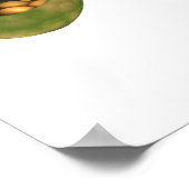 胆石内部の概念図 ポスター (角)