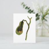 胆石内部の概念図 ポストカード (スタンド正面)