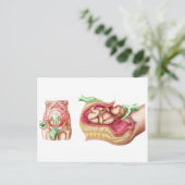 胎児の帝王切開分娩を示すイラストレーション ポストカード (スタンド正面)