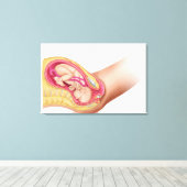胎児2の分娩を示すイラストレーション キャンバスプリント (インサイチュ (ウッドフロア))