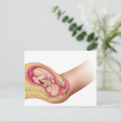 胎児2の分娩を示すイラストレーション ポストカード (スタンド正面)