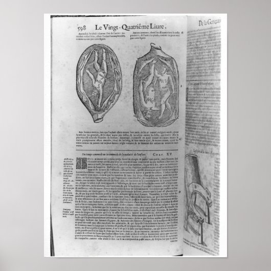 胎児、'Oeuvres'からのイラストレーション ポスター (正面)