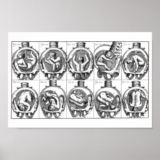 胎内ベビーヴィンテージ助産師解剖学イラストレーション ポスター (正面)