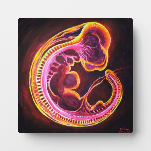 胚 フォトプラーク (正面)