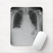 胸部レントゲンの~のmousepad マウスパッド (マウス)
