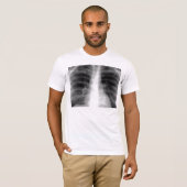 胸部レントゲン Tシャツ (正面フル)