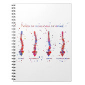 脊柱の脊柱側彎症のタイプ ノートブック (正面)
