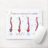 脊柱の脊柱側彎症のタイプ マウスパッド (マウス)