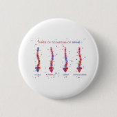 脊柱の脊柱側彎症のタイプ 缶バッジ (正面)