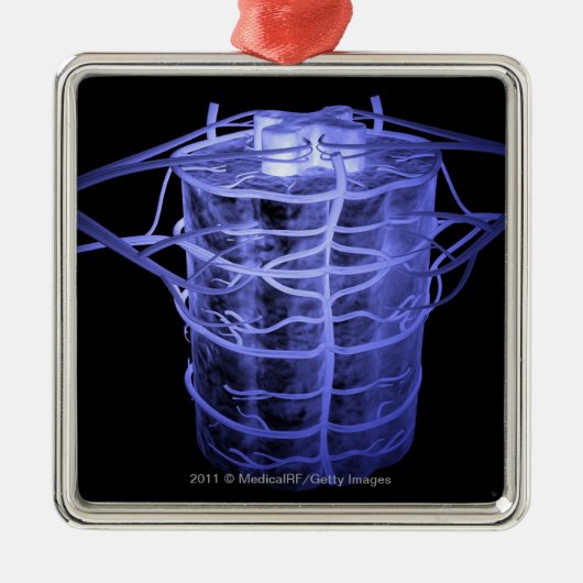 脊柱の部分を囲む動脈 メタルオーナメント (正面)
