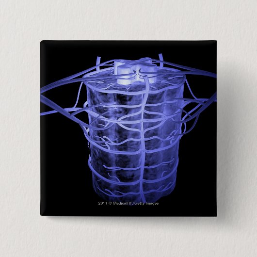 脊柱の部分を囲む動脈 缶バッジ (正面)