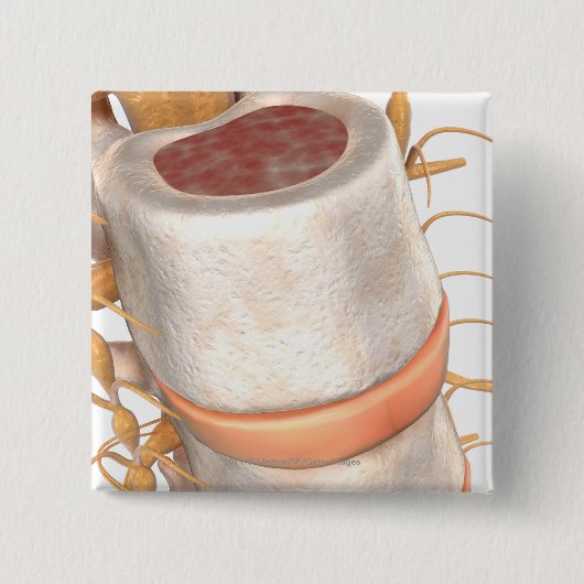 脊柱のinvertebralディスクの閉めて下さい 缶バッジ (正面)