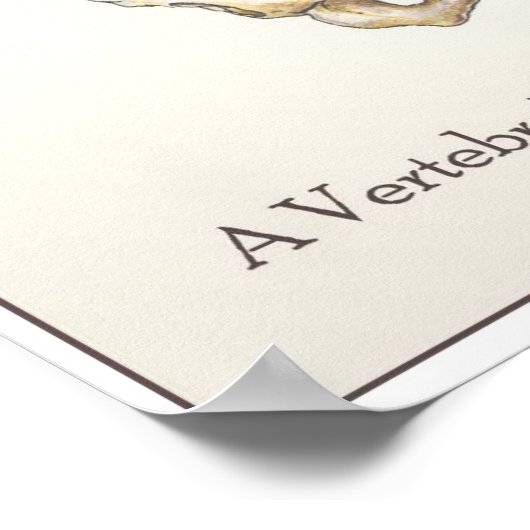 脊柱側弯症 ポスター (角)