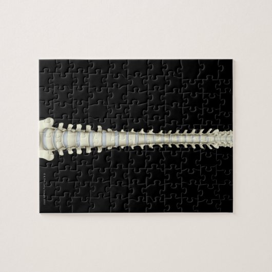 脊柱2 ジグソーパズル (横)