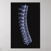 脊柱3 ポスター (正面)