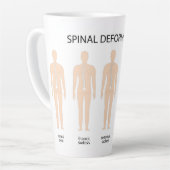 脊椎変形構造 カフェラテマグ (左アングル)