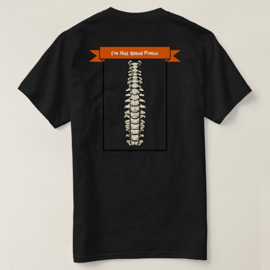「脊椎融合を患っていたと判断するな」 Tシャツ (デザイン裏面)