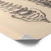 脊椎解剖学カイロプラクティックプリント ポスター (角)