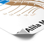 脊髄と皮膚腫の地図 ポスター (角)