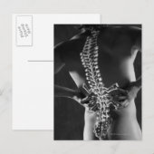 脊髄ビュー ポストカード (正面/裏面)