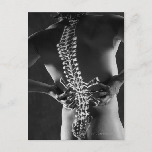 脊髄ビュー ポストカード (正面)