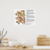 脊髄亜脱臼カイロプラクティックポスター ポスター (キッチン)