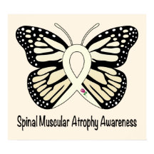脊髄性筋萎縮（症）