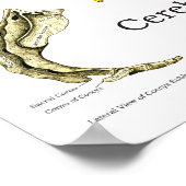 脊髄神経カイロプラクティック脱臼 ポスター (角)