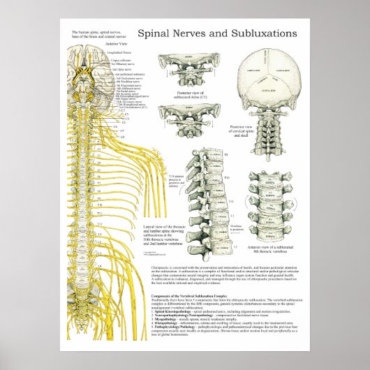 脊髄神経・亜脱臼カイロプラクティックポスター ポスター (正面)