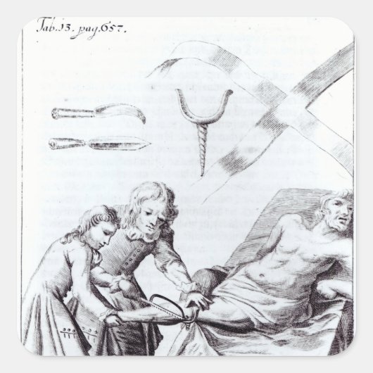 脚を切断する外科手術 スクエアシール (正面)