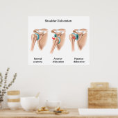 脱臼した肩ポスター ポスター (キッチン)