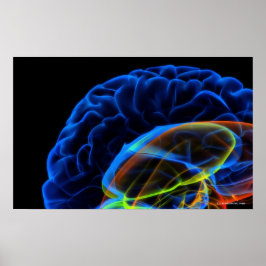 脳のX線画像 ポスター