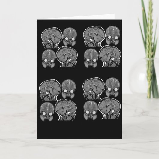 脳め！(MRI) カード (正面)