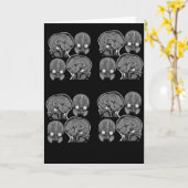 脳め！(MRI) カード (黄色い花)