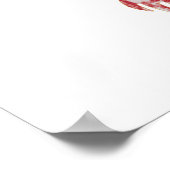 脳動脈瘤バタフライ6.1 ポスター (角)