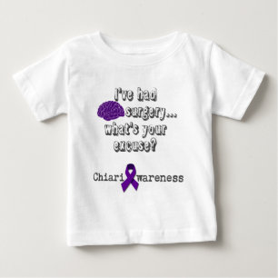 脳外科手術 ベビーTシャツ