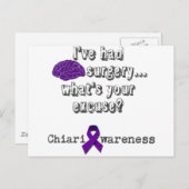 脳手術 ポストカード (正面/裏面)