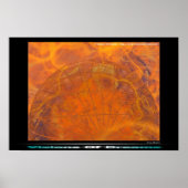 脳炎 ポスター (正面)