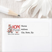 脳腫瘍に関する希望 ラベル (インサイチュ)