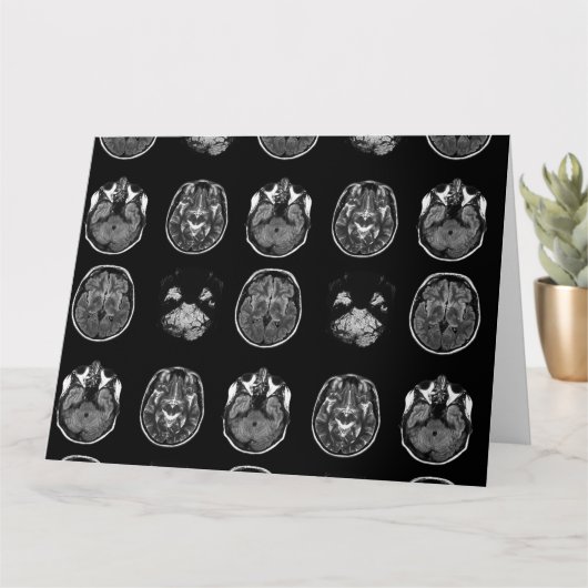 脳MRIスキャン カード (小さな植物)