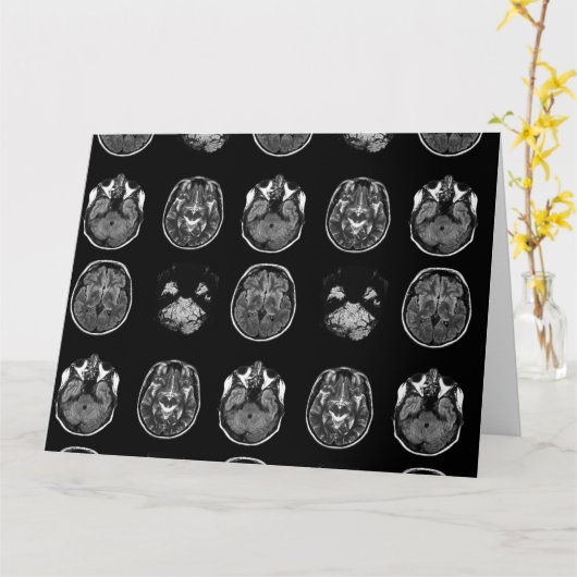脳MRIスキャン カード (黄色い花)