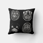 脳MRIスキャン クッション (裏面)