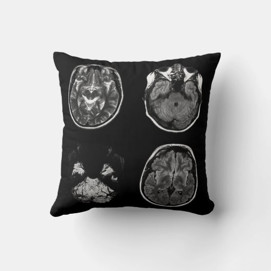 脳MRIスキャン クッション (裏面)