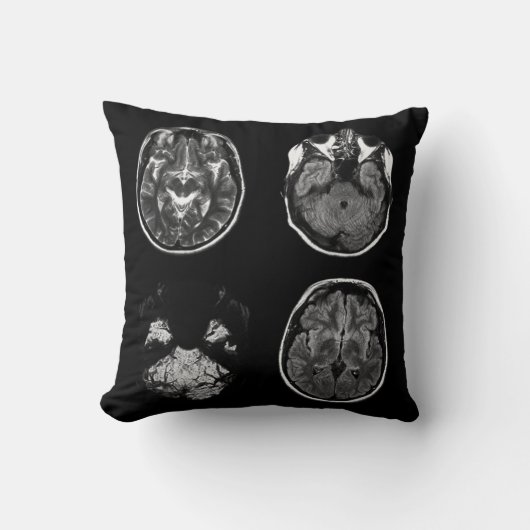脳MRIスキャン クッション (正面)