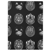 脳MRIスキャン クリップボード (裏面)